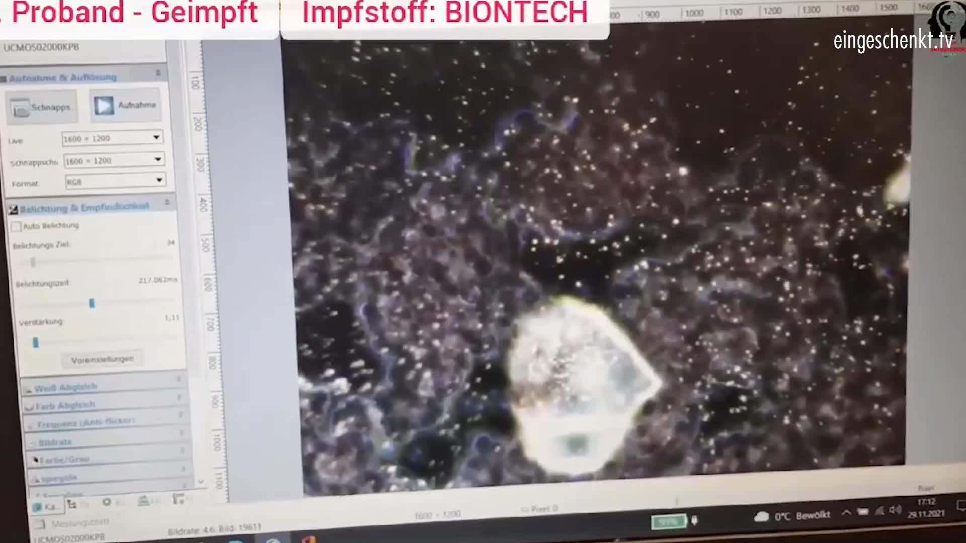 Das_Blut_der_Geimpften_unter_dem_Dunkelfeldmikroskop